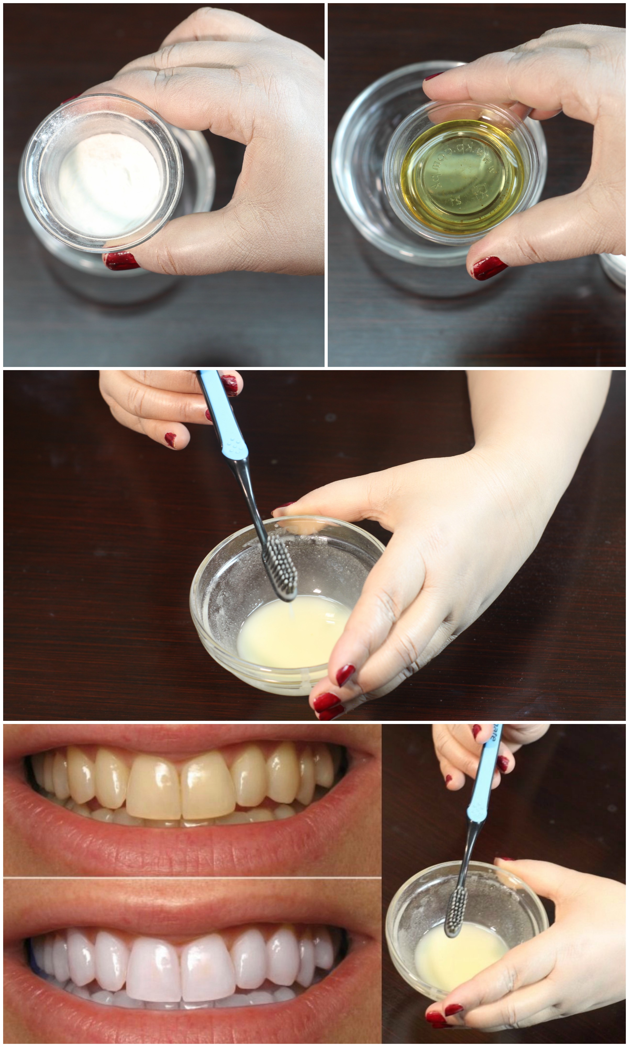 how to whiten your teeth 