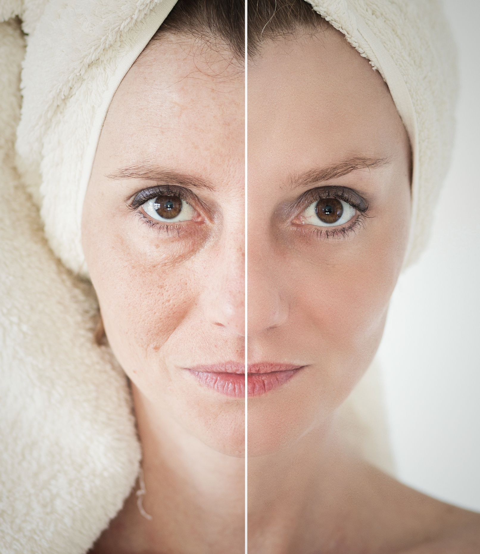 best anti aging skin skin