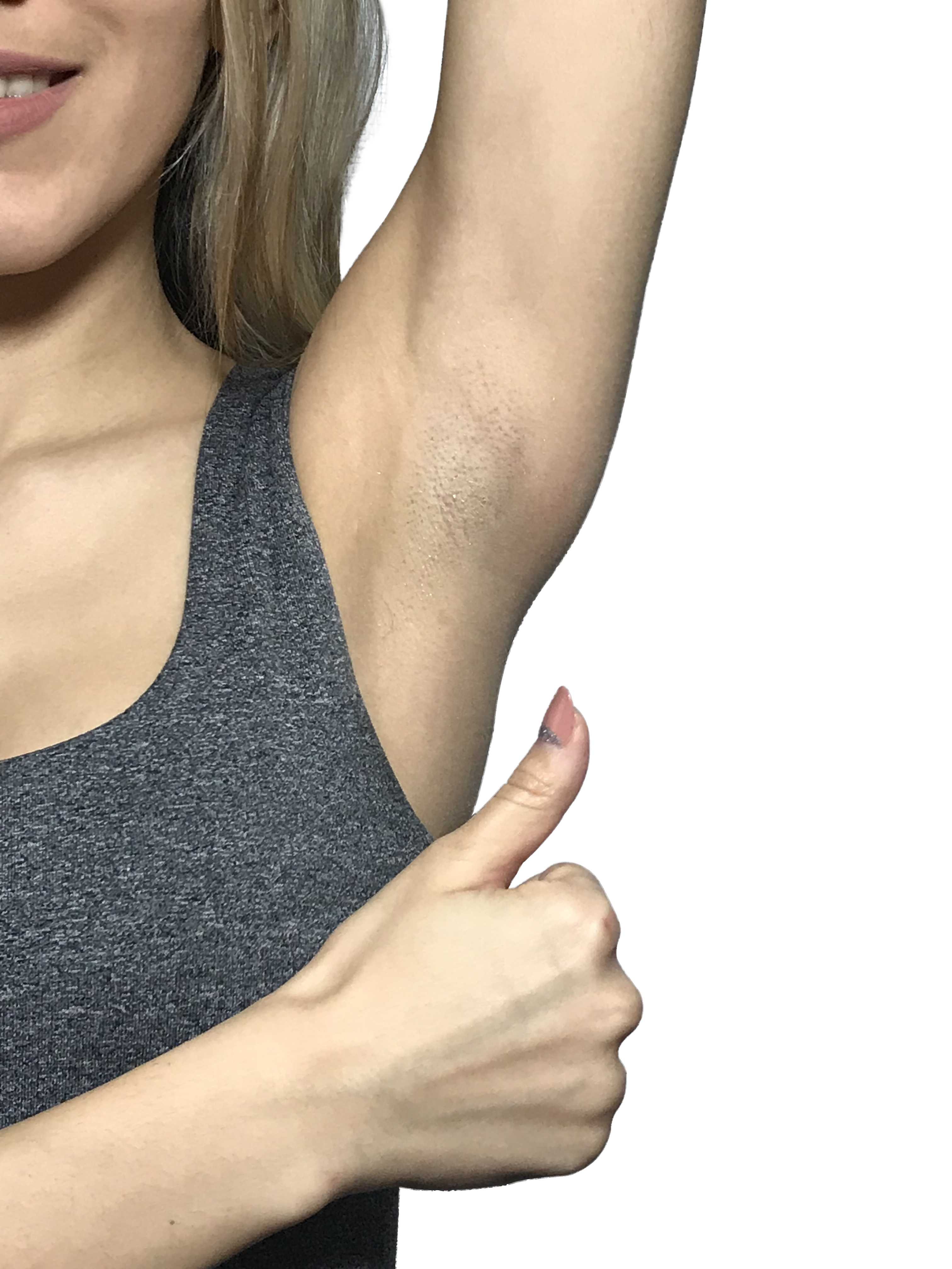 natural remedies to lighten dark armpits