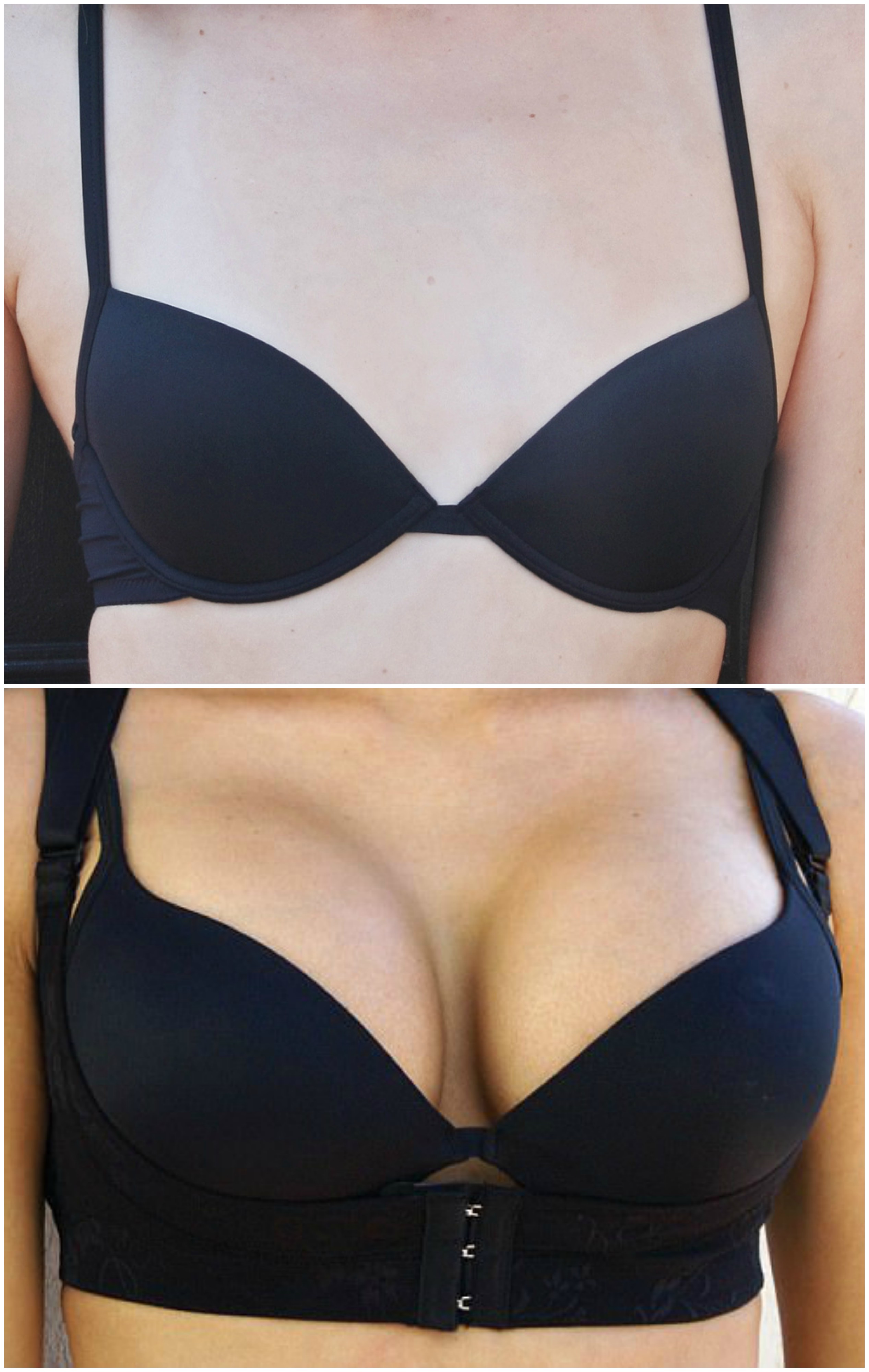 home remedies for breast enlargement