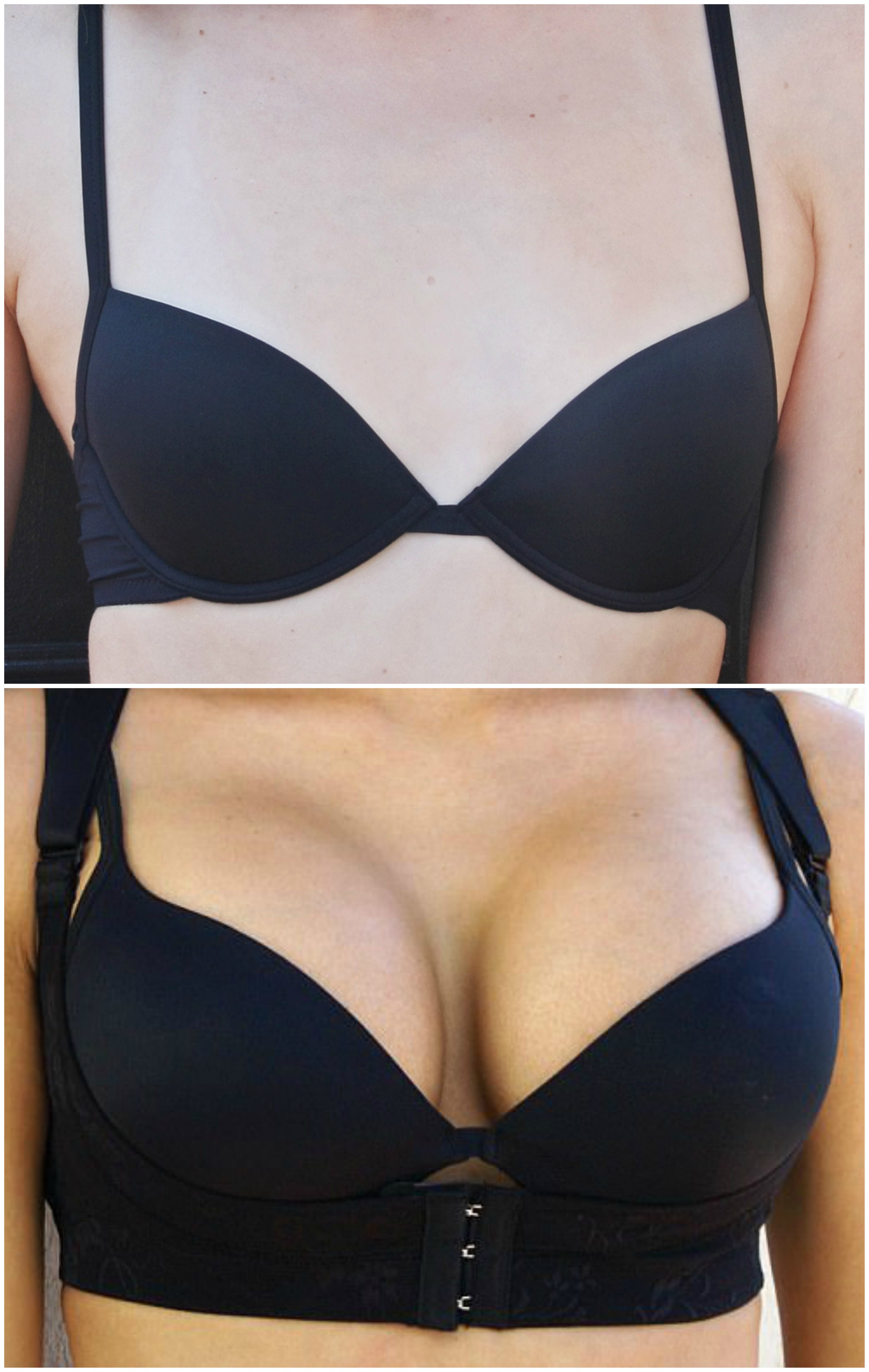 Fix Sagging Breasts Naturally With Some Simple Home Remedies - Healthwire