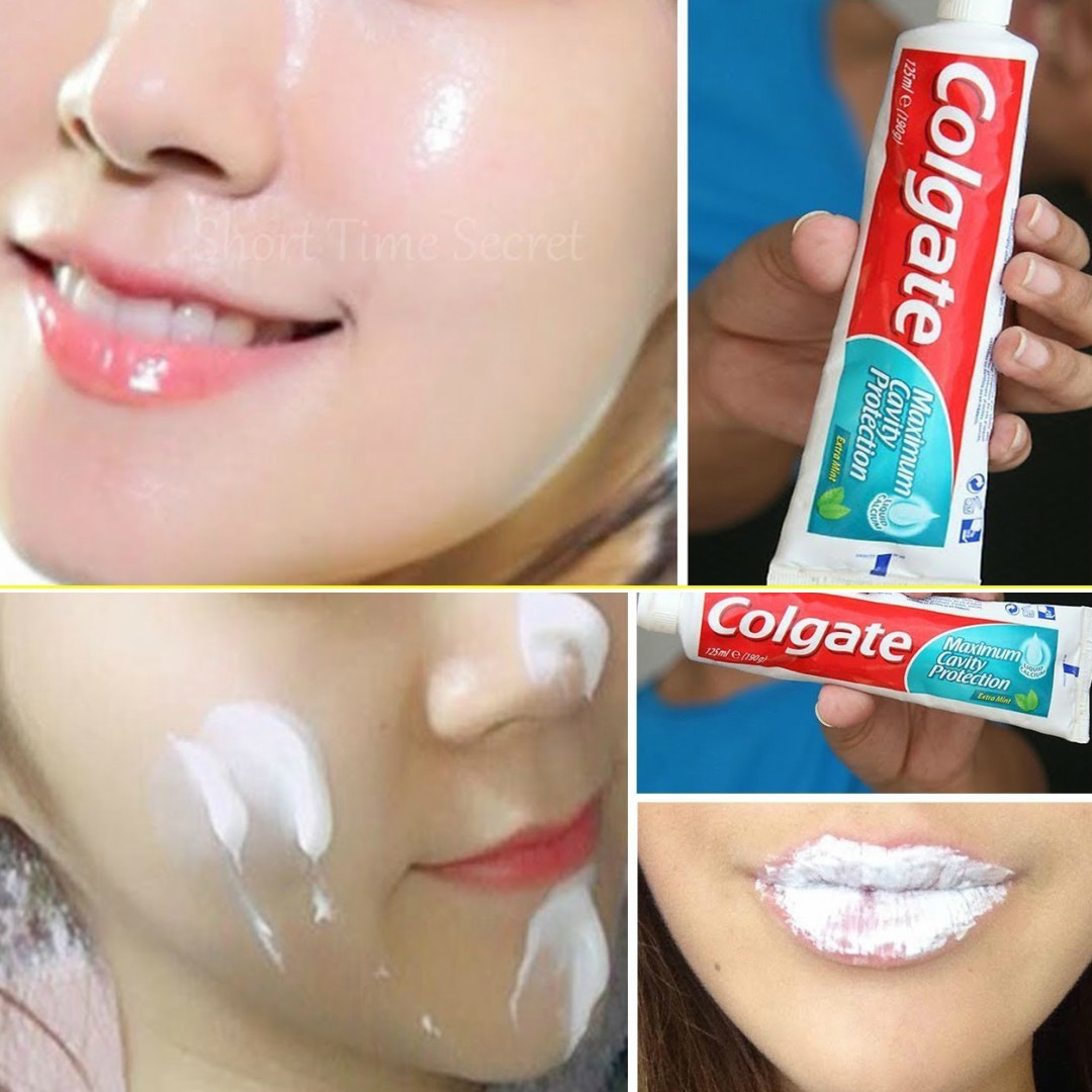 6 Amazing Toothpaste Beauty Hacks | Amazing Toothpaste ...