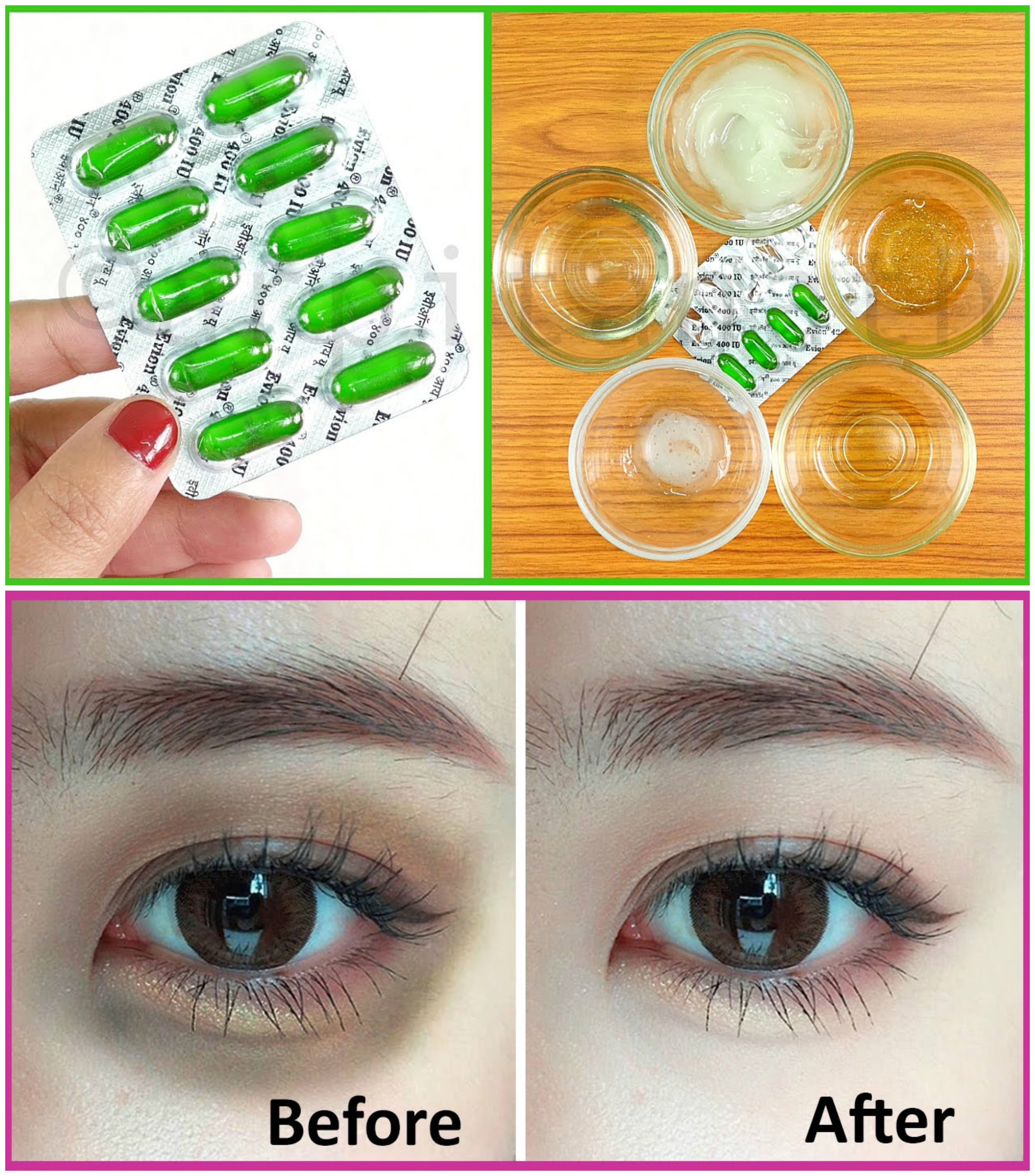 download dark circles around eyes