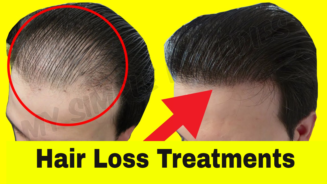 The Emerging Challenges For Core Factors For Hair Loss Treatment - A ...
