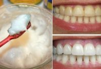 how to whiten your teeth